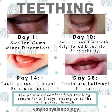 Teething 🦷 & Sleep 💤 ☑️Fact: Teething can be responsible for a few tough nights... not 15-20! If teething is always being blamed.. reach out for help. Swipe to the right 👉🏻 and let us know which stage your little one is at with their teething! 👩 Tag a mama who might find this info helpful! Credit: @mybabysleepology ⁠ Teething | teething facts | mom memes | toddler memes⁠ ⁠ #realmom #momsupportingmom #newmom #pee #realmotherhood #beingamom⁠ #momhack #momhacks #momtips #lifehack #babycryi... Teething Stages Baby, Teething Hacks, Teething Stages, Baby Routine, Teething Baby, Baby Help, Be Responsible, Newborn Baby Tips, Newborn Mom