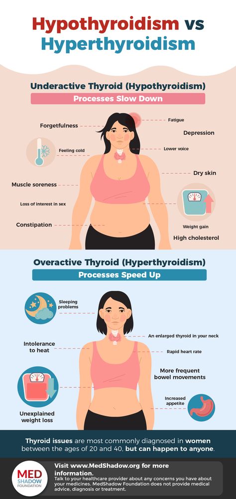 When your thyroid is underactive, it isn’t making enough thyroid hormones. Many processes in your body can slow down as a result. When your thyroid is overactive, it’s making too much thyroid hormone and can speed some of your body’s processes up. It’s much less common than hypothyroidism. Hypothyroid Supplements, Hyperthyroid Symptoms, Hypothyroid Symptoms, Natural Thyroid Remedies, Thyroid Diet Plan, Low Thyroid Remedies, Enlarged Thyroid, Thyroid Remedies, Adrenal Gland