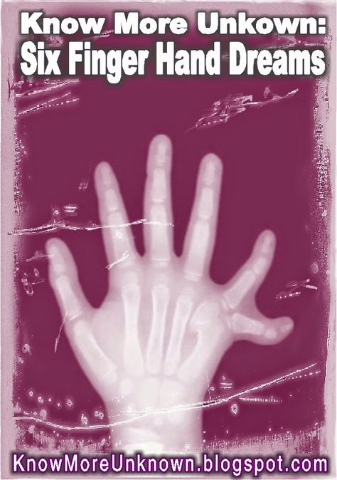 Understand your dreams:  "When the woman held out her hand to shake mine, I saw that her hand had six fingers.  The last finger seemed to be pointing in a weird way.  It caught me by surprise, and I was pretty disgusted." Six Fingers, Dream Analysis, Finger Hands, Shaking Hands, My Mother, Understanding Yourself, Kirby, Last Night, I Saw