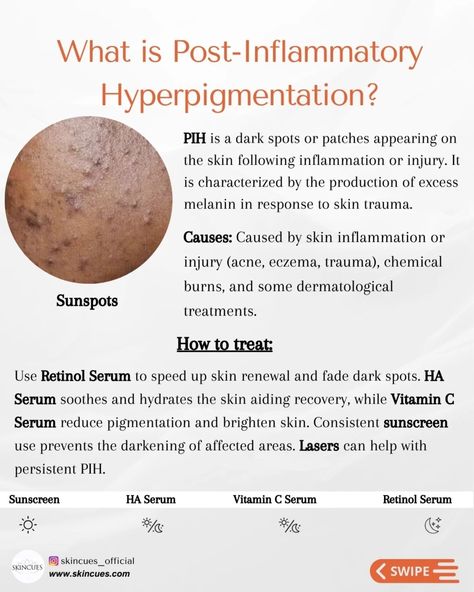 Angel Aesthetics, Hyperpigmentation Skincare, Skin Challenge, Skin Care Hyperpigmentation, Post Inflammatory Hyperpigmentation, Clean Blackheads, Simple Skincare Routine, Skin Science, Basic Skin Care Routine