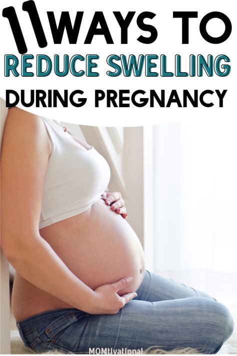 Best tips and tricks for swelling during your third trimester. Learn the best home remedies for swollen feet during pregnancy! Are the bottom of feet swollen during pregnancy? Get rid of achy pain with these easy and NATURAL changes that could help greatly. While some swelling during pregnancy is normal, there are a couple of things that you can do to reduce swelling during pregnancy. #swellingduringpregnancy #edema #reduceswelling Swelling Remedies, Pregnancy Swelling, Hiding Pregnancy, Pregnancy Remedies, Inflammation Remedies, Swollen Knee, Pregnancy Pain, Postpartum Health, Pregnancy Must Haves