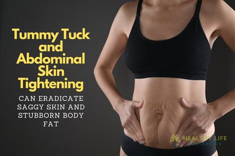 Discover the transformative benefits and recovery process of panniculectomy, a surgical procedure aimed at removing excess skin and fat. - #Abdominalskinreduction #Bellyskinremoval #Bodyreshapingsurgery #Bodysculptingsurgery #Cosmeticsurgeryforexcessskin #Excessskinexcision #Looseskinsurgery #Panniculusremoval #Procedureforeliminatinglooseskin #Skinandfatreduction #Skinflabremoval #Skintighteningsurgery #Surgerytoremoveexcessskin #Surgicalsolutionforskinfolds #Surgicaltreatmentforabdominalskin Loose Skin Surgery, Body Sculpting Surgery, Body Contouring Surgery, Lip Care Routine, Excess Skin, Saggy Skin, Health Insurance Plans, Laser Therapy, Fat Reduction