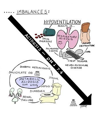 Hypoventilation Nursing Information, Nursing Mnemonics, Nursing School Survival, Acid Base, Respiratory Therapy, Nurse Rock, Nursing School Studying, Nursing School Tips, Nursing School Notes