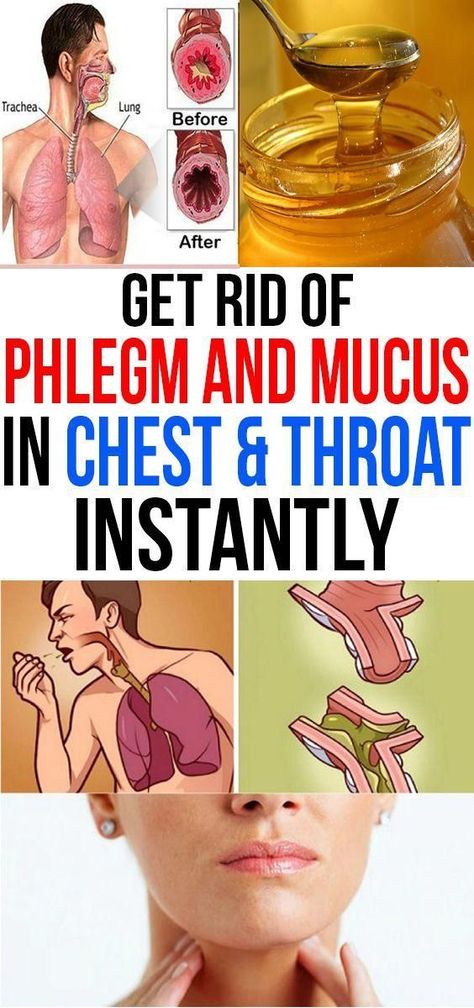 Get Rid of Phlegm and Mucus in Chest & Throat Instantly Phlegm In Throat, Mucus In Chest, Mucus In Throat, Get Rid Of Cough, Getting Rid Of Mucus, Remedy For Sinus Congestion, Mucus Relief, Getting Rid Of Phlegm, Home Remedies For Sinus