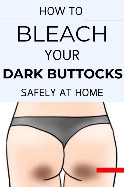 Sybil Prentice How To Get Rid Of Dark Buttocks, Hyperpigmentation On Buttocks, Dark Buttocks, Buttocks Acne, Perfect Skin Tone, Natural Skin Lightening, Home Remedies For Skin, Diy Skin Care Routine, Home Simple