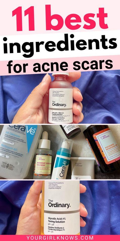 Want to know how to heal acne scars? You better have a darn good skincare routine with these ingredients in any of your products. These will save your skin and you'll thank me later! | acne scar mask, acne scar removal, products for acne scars, acne scars skin care routine, how to clear acne scars, how to help acne scars, how to fix acne scars, ingredients for acne scars | Fix Acne, Scar Mask, Ingredients For Acne, Skincare Routine Acne, Best Acne Scar Removal, Acne Scar Mask, Fall Makeup Trend, Best Acne Products, Peeling Mask