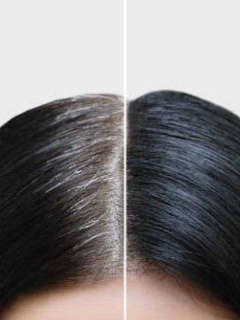 ​How To Turn Your Grey Hair To Black Naturally What Causes Gray Hair, Stop Grey Hair, Black And Grey Hair, How To Darken Hair, Hair And Nail Salon, Skin Care Salon, Beauty Gift Card, Temporary Hair Color, Sunless Tanning