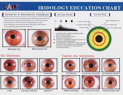 Iridology Chart, Eye Color Chart, Body Chart, Eye Chart, Naturopathy, Alternative Therapies, Reflexology, Eye Health, Homeopathy