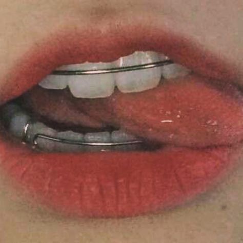 Braces, Lips, Red