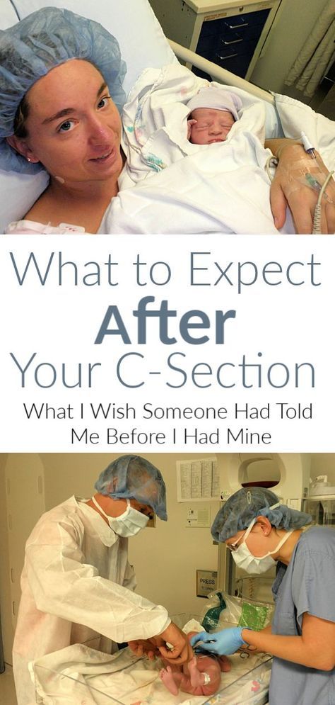 What to Expect After a C-Section C Section Photos, Baby Delivery Announcement, C Section Pictures, C Section Photography, C Section Tips, C Section Recovery Essentials, Hospital Pictures Newborn, C Section Recovery Timeline, Breastfeeding After C Section