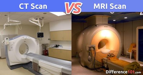 What Is The Difference Between An MRI And A CT Scan?  CT Scan vs. MRI: Discover the Similarities and the Key Differences between CT Scan and MRI, which is better and safer, as well as what they can detect.  Read more → https://bit.ly/308EZd4  #ctscan #mriscan #faq #healthampmedecine #difference101 #difference #comparison #versus #vs #differences #comparisons #knowthedifference Mri Brain, Cat Scan, Brain Scan, Mri Scan, Magnetic Resonance Imaging, Ct Scan, Magnetic Resonance, Bones And Muscles, What Is The Difference Between