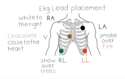 Ekg, electrodes, lead placement, nursing, nursing notes, mnemonic, cheat sheet, study sheet, nurse, cardiac, diagram 3 Lead Ekg Placement, 5 Lead Ekg Placement, Ekg Placement, Ekg Leads, Nerve Anatomy, Medical Terminology Study, College Survival Guide, Family Nurse Practitioner, Study Essentials