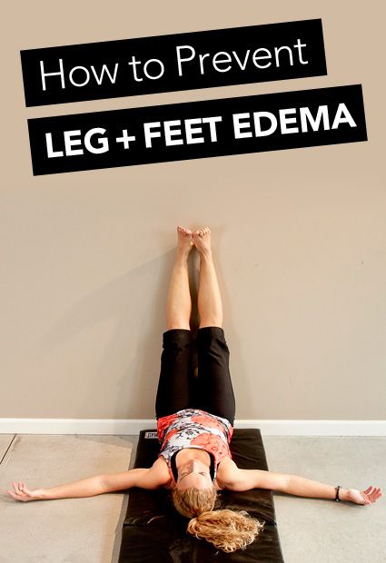 How do we define edema? Well, it’s just a fancy word for swelling that takes place in the body. This swelling can occur for different reasons ... Swelling Remedies, Edema Causes, Grapefruit Benefits, Water Retention Remedies, Sore Legs, Swollen Knee, Swollen Ankles, Swollen Legs, Knee Exercises