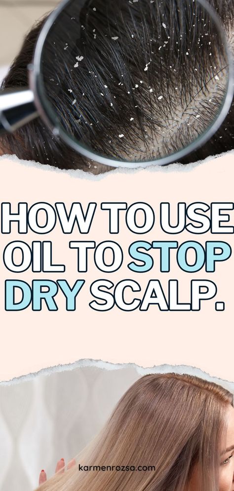 How to use oil to stop dry scalp. Nourish and revitalize your dry hair with the best tips. Explore DIY hair treatments and hair growth remedies that nourish and strengthen. Discover sulfate-free shampoos and organic hair products for colored hair, offering gentle care and hydration. Whether you're managing frizzy hair or looking for vegan options, learn easy hairstyles tutorials and hair care routines tailored to your needs. Say hello to healthier, hydrated hair and scalp today! #HairCareTips Remedies For Dry Hair, Easy Hairstyles Tutorials, Dry Scalp Remedy, Hair Growth Remedies, Hair Oil For Dry Hair, Organic Hair Products, Natural Remedies For Migraines, Olive Oil Hair, Coconut Oil Hair Mask