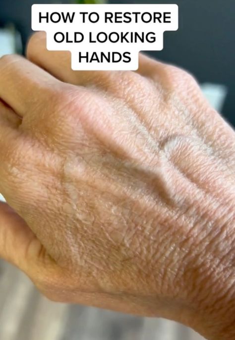 Hand Wrinkles Remedies, Hand Rejuvenation Anti Aging, Aged Hands, Hand Care Routine, Wrinkles Hands, Anti Aging Hands, How To Make Cream, Eye Cream For Dark Circles, Anti Aging Wrinkles