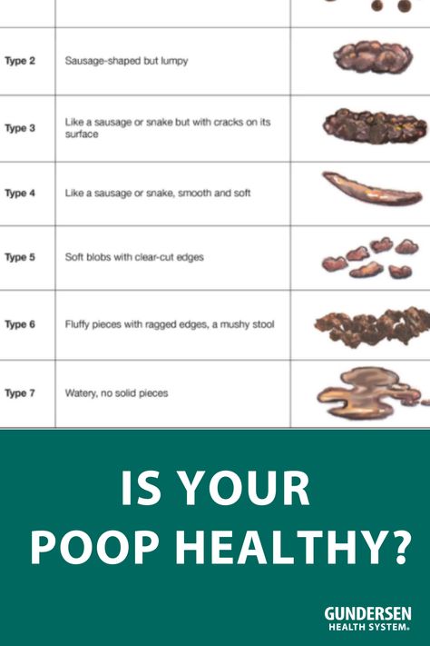 Bristol stool chart Bristol Stool, Bristol Stool Chart, Stool Chart, Soft Stool, Cool Tools, Gut Health, Bristol, Health And Wellness, Nutrition