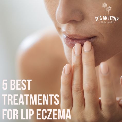 5 Best Treatments for Lip Eczema Lip Allergy, Itchy Eyelids, Chapped Lips Remedy, Lip Salve, Homemade Oil, Skin Condition, Exterior Makeover, Chapped Lips, Itchy Skin