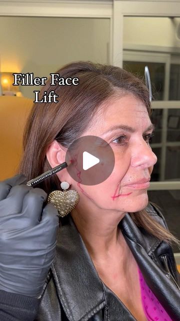 LIFTED BEAUTY on Instagram: "Filler Face Lift 🤩  To book an appointment text or call our office at (562) 331-6543   Click the link in our bio to see our online schedule to book an appointment with one of Our Medical Providers 📲 . Want More Info Before Coming in? Book A Free Consultation Call with Our Patient Care Coordinator ✨ . $45.00 Booking Fee Required To Book An Appointment 💰 . ⚠️Cancellation Policy ⚠️ $100 will be charged if appointment is not canceled within 48hrs of Scheduled Appointment Time . All products are FDA approved. Please visit the manufacturers website of the products that we use for all risk and side effects 🙌🏼 . All our treatments are customized to fit our patients anatomy and needs. Keep in mind that the number of units, syringes, threads or sessions needed will