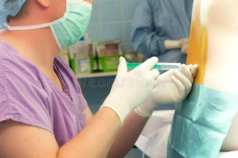 Spinal anesthesia. Close-up of anesthetist with gloves and nail making epidural , #SPONSORED, #anesthetist, #gloves, #Close, #Spinal, #anesthesia #ad Spinal Anesthesia, Epidural Birth, Nail Making, Birth Labor, Stock Photography Free, Labor, Close Up, Gloves, Stock Images