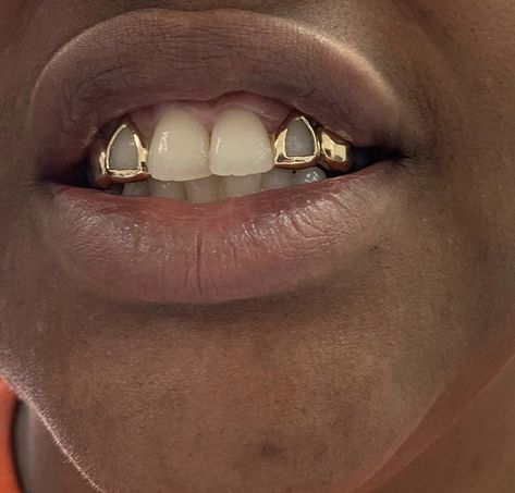 Side Tooth Grill, Grillz For Men, Silver Grillz Men, Men Grillz, Grillz Teeth Men, Grillz Men, Gold Teeth Grills, Open Face Grillz, Girl Grillz