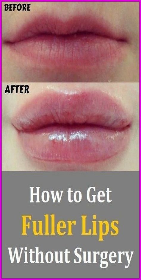 HOW TO GET FULLER AND BETTER LIPS WITHOUT SURGERY??? Full Lips Natural, Fuller Lips Naturally, Health And Wellness Quotes, Health Routine, Full Lips, Natural Health Tips, Cosmetic Procedures, Beauty Advice, Lip Fillers