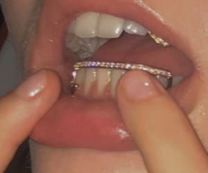 Girls With Grills, Girl Grillz, Pretty Teeth, Grillz Teeth, Diamond Grillz, Diamond Teeth, Grills Teeth, Tooth Gem, Teeth Jewelry