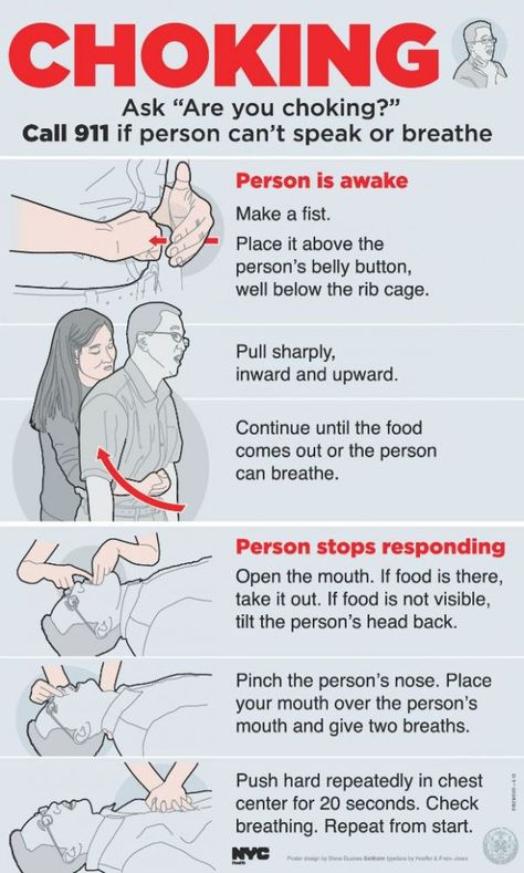 Make sure you know what to do in the event that someone is choking. Knowing these steps could save someone's life. Heimlich Maneuver, First Aid Tips, Survival Skills Life Hacks, Medical School Essentials, Survival Life Hacks, Apocalypse Survival, Survival Techniques, Survival Life, Medical Knowledge