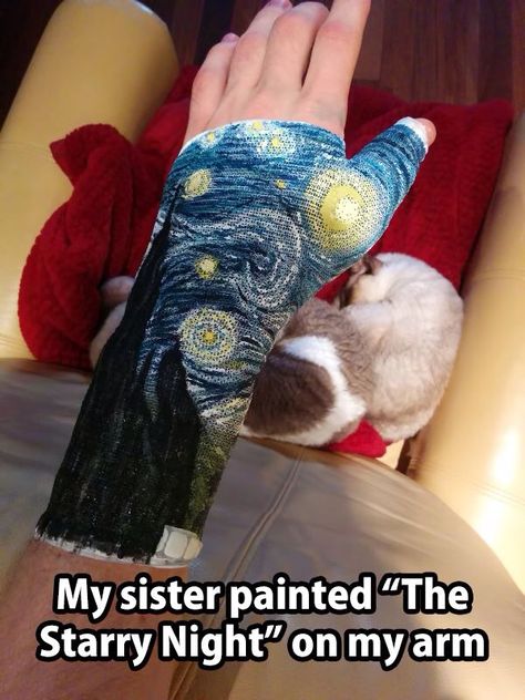 Love this Arm Cast, Iron Woman, Leg Cast, Cast Art, Arm Art, Starry Night Van Gogh, Illustration Sketches, Art Google, Flash Tattoo