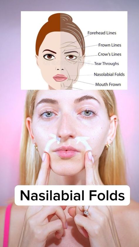 Nasolabial Folds Get Rid Of, Nasolabial Folds Exercises, Get Rid Of Nasolabial Folds, Nasal Labial Folds Face Exercises, Face Yoga Exercises For Jowls, Exercises For Jowls Face Yoga, Face Yoga Nasolabial Folds, Facial Massage Steps, Face Massage Anti Aging