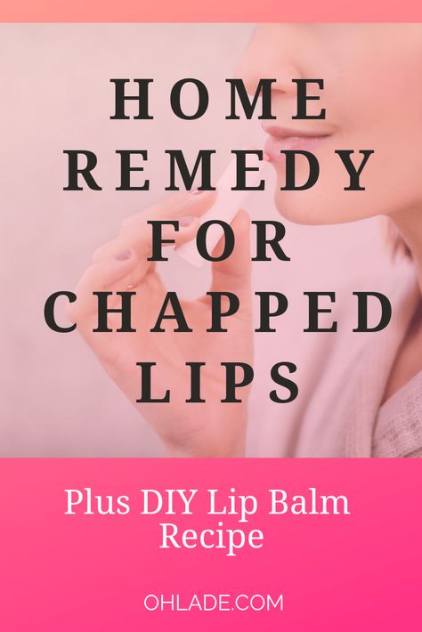 A Home Remedy for Chapped Lips and DIY Lip Balm Recipe. Don't let your lips get dry and cracked this season- try this awesome homemade chap-stick and lip balm scrub to keep lips looking healthy and pretty. #diylipbalmrecipe #homeremedyforchappedlips| OhLaDe Remedy For Chapped Lips, Lip Balm Recipe, Home Remedies For Allergies, Home Remedies For Warts, Diy Lip Balm Recipes, Warts Remedy, Balm Recipe, Natural Remedies For Migraines, Lip Balm Recipes