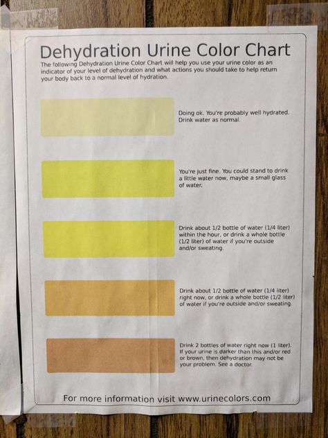 Pee Color Chart, Pee Color Meaning, Pee Chart, Pee Color, Water Goals, Color Checker, Color Meanings, Color Help, Health Facts