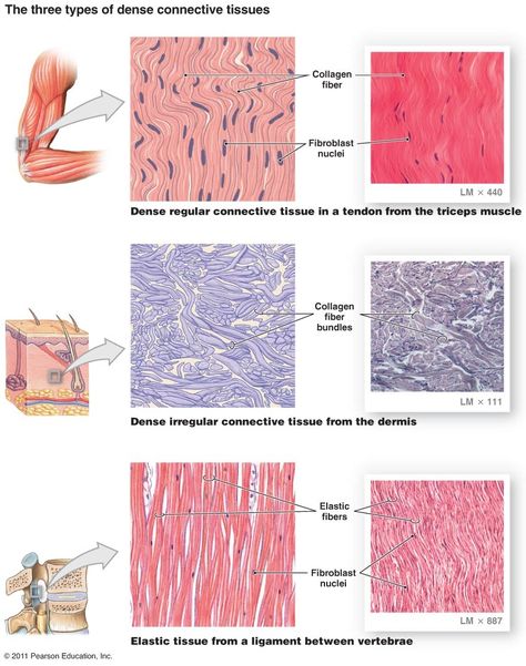 Types of dense connective tissue Diffusion Osmosis, Tissue Biology, Basic Anatomy And Physiology, Tissue Types, Nursing Student Tips, Medical Student Study, Biology Lessons, Medicine Student, Nursing School Tips