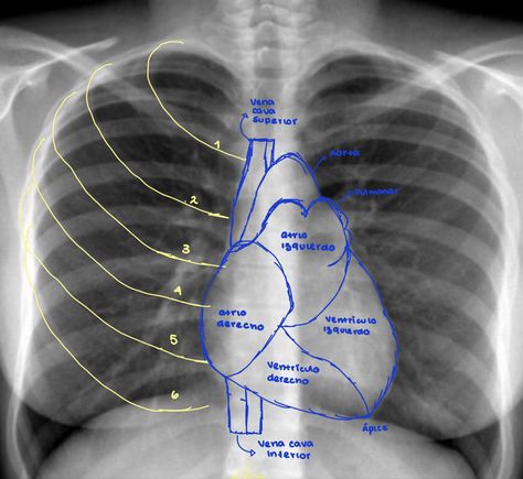 Thorax Anatomy, Radiology Schools, Medical Radiography, Radiology Student, Studying Medicine, Medical School Life, Medicine Notes, Basic Anatomy And Physiology, Medicine Studies