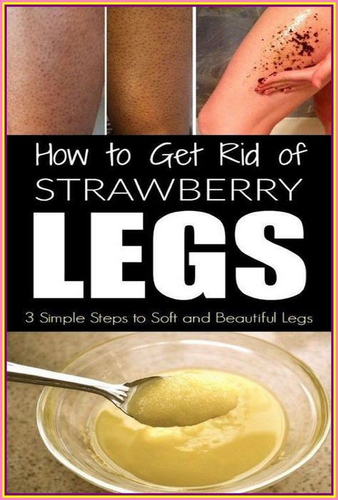 How to Get Rid of Strawberry Legs Slim Fast Diet Plan, Sunburn Peeling, Dry Skincare, Natural Face Care, Strawberry Legs, Workout List, Health Tips For Women, Perfect Skin Care Routine, Sheet Masks