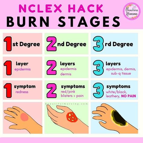 Burns Nursing, Nursing School Life, Medical Study, Nursing School Essential, Nursing School Motivation, Medical School Life, Nurse Study Notes, Nursing Mnemonics, Nursing Student Tips