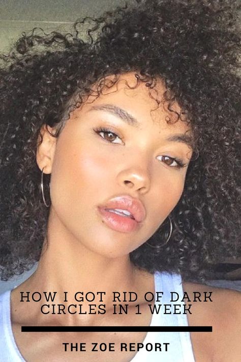 How I Got Rid Of My Dark Circle In 1 Week Get Rid Of Dark Circles Under Eyes, Sleeping Schedule, Dark Circle Remedies, Get Enough Sleep, Dark Eye Circles, Scaly Skin, Enough Sleep, Hair And Makeup Tips, Dark Circles Under Eyes