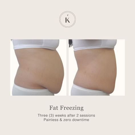 Fat Freezing, Dental Posts, Beauty Clinic, Medical Spa, Life Changes