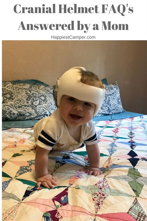 Cranial Helmet Designs Boys, Cranial Helmet Designs, Doc Band Wraps, Cranial Helmet, Doc Band, Baby Helmet, Heat Rash, Mom Life Hacks, Band Mom