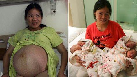 Farmer Woman Gives Birth to Quadruplets in China | Pregnant Life Farmer Woman, Pregnant Life, Multiple Births, Giving Birth, Pregnant Belly, Pregnant Women, The Four, Farmer, Twins