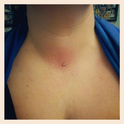 Throat Dermal Throat Dermal Piercing, Dermal Piercing, Piercing Tattoo, Tattoos And Piercings, Body Art, Piercings, Nose Ring, Tattoos, Skin