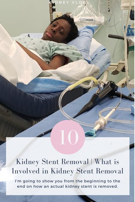 I show you from the beginning to the end on how an actual kidney stent is removed. How To Dissolve A Kidney Stone, Kidney Surgery, Kidney Stone, Homemade Facial Mask, To The End, Healthy Habits, The Beginning, Surgery, The End