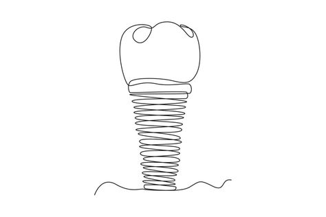 Dental Wall Art, Tooth Implant, Denture Implants, Teeth Implants, Single Line Drawing, One Line Drawing, Single Line, Dental Health, Design Vector