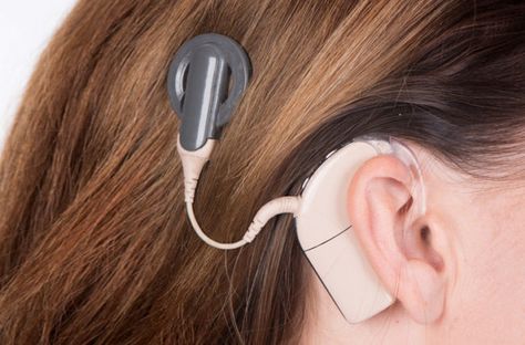 Cochlear Implants, Speech And Hearing, Human Ear, Mri Scan, Cochlear Implant, Inner Ear, Cleveland Clinic, Train Your Brain, Hearing Loss