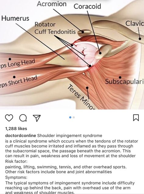 Clavipectoral Fascia, Rotator Cuff Exercises, Rotator Cuff Surgery, Shoulder Impingement, Rotator Cuff Injury, Brain Anatomy, Human Body Anatomy, Rotator Cuff, Bones And Muscles