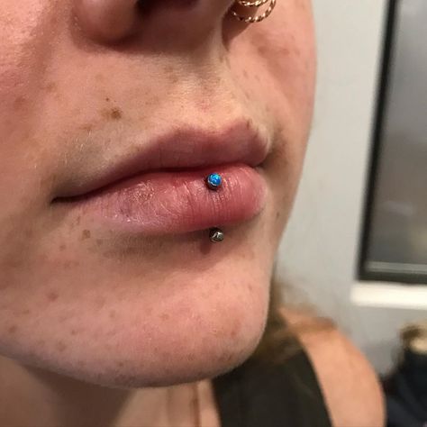 Aaron Victory on Instagram: “Vertical Labret with blue opal top @thebellrosetattoo Thanks Madeline! #piercing #verticallio #piercing #titanium #opal” Vertical Labret Piercing, Vertical Labret, Labret Piercing, Lip Piercing, Body Mods, Blue Opal, Victorious, Piercings, Opal