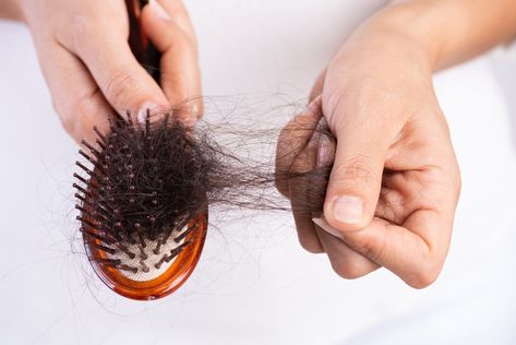 Here, all the reasons you may be suffering from hair loss, from alopecia to hormone imbalances, and how to treat it. Thicker Hair Naturally, Help Hair Grow, Androgenetic Alopecia, How To Grow Your Hair Faster, Extreme Hair, Hair Control, Lost Hair, Hair Growth Tips, Roots Hair