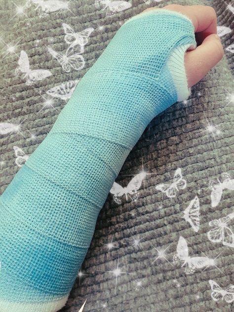 Hand Fracture Pics With Plaster, Hand Fracture Pics, Burned Hand Pic, Pic Birthday, Hand Fracture, Alien House, Dr Aesthetic, Fake Injury, Passport Pictures