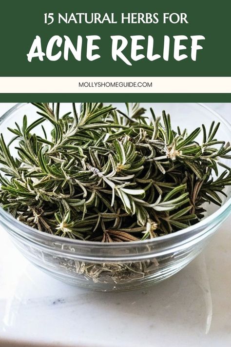 15 Natural Herbs for Acne Relief Natural Remedies For Acne Skincare, Herbs For Acne, Painful Acne, Herbal Oils, Beauty App, Natural Acne, Natural Acne Remedies, Essential Oils For Skin, Acne Solutions