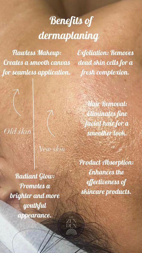 DERMAPLANING THE SKIN Facials Quotes, Facial Benefits, Esthetician Inspiration, Esthetician Marketing, Zen Den, Skin Care Business, Skin Aesthetics, Unwanted Facial Hair, Nutrition Diet