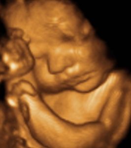 3D Ultrasound 3d Ultrasound, 3d Images, Baby Art, Ultrasound, Portrait Tattoo, Art